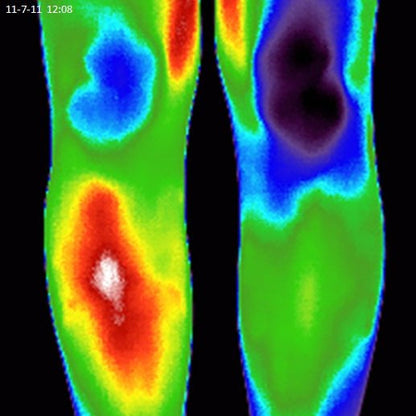 Thermal image of legs before and after using Elixir Mind Body Botanicals Relief Balm from Elixir Mind Body Boutique