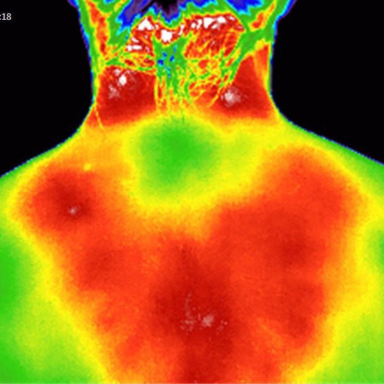 Elixir Mind Body Botanicals Relief Before Thermal Image of Back and Neck before - Elixir Mind Body Boutique
