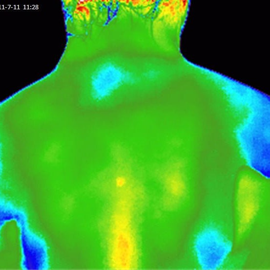 Elixir Mind Body Botanicals Relief After Thermal Image of Back after  - Elixir Mind Body Boutique